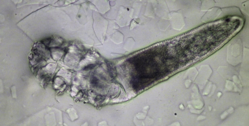 Fig 2. Adult Demodex brevis